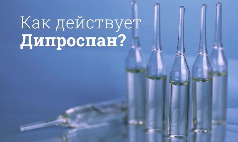 Дипроспан схема уколов