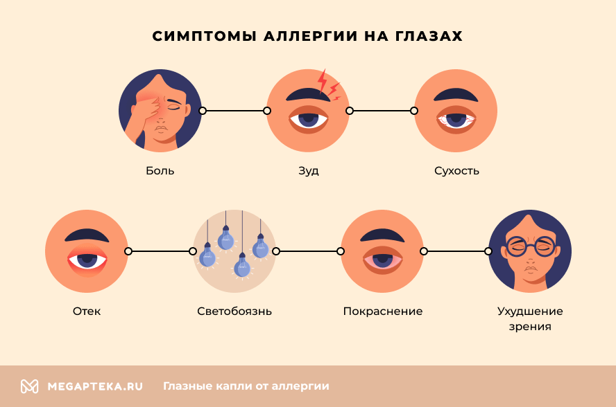 Глазная аллергия. Как выглядит глазная аллергия. Как проявляется аллергия на глазные капли. Реакции глазами ребенка.