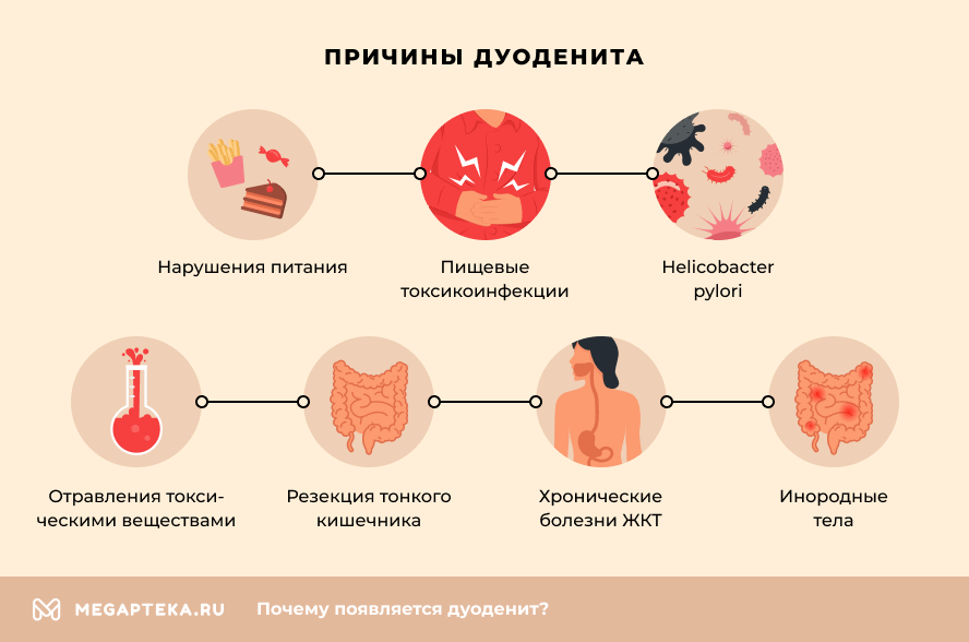 Симптомы хронического дуоденита